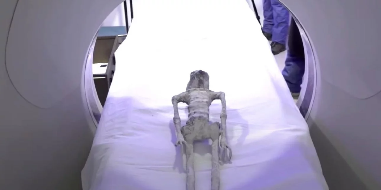 Μεξικό: «Αυθεντικοί» οι σκελετοί λένε επιστήμονες μετά από ακτινογραφίες στα λείψανα των… «εξωγήινων»