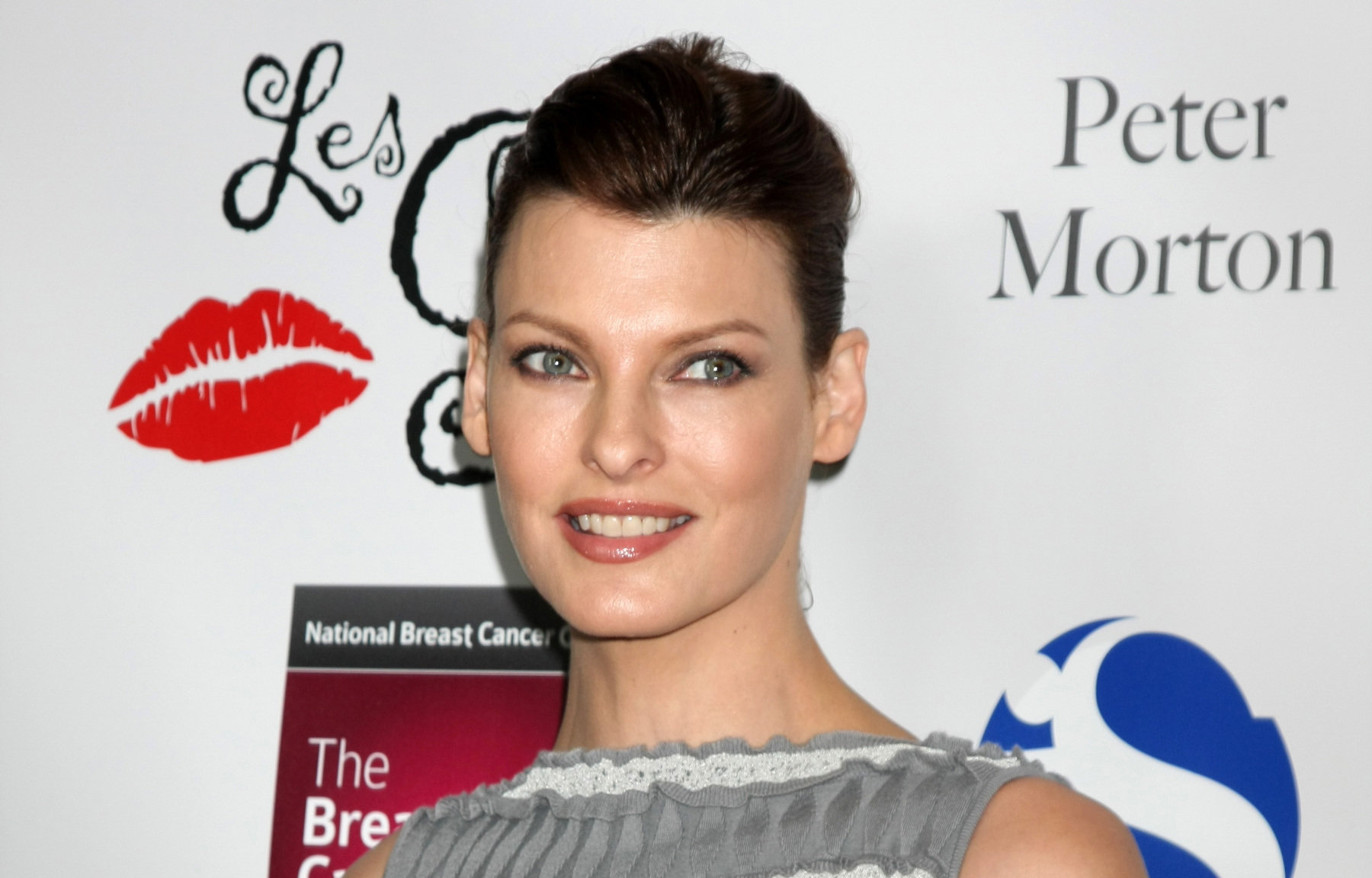 Linda Evangelista: Εξομολογείται ότι παραμορφώθηκε το πρόσωπό της – «Δε θέλω πια να ντρέπομαι για μένα»